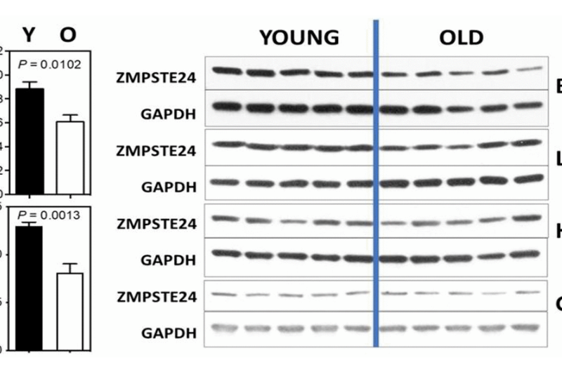 Lamin A to Z in normal aging
