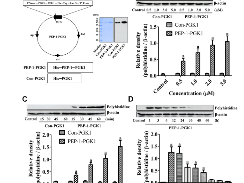 Phosphoglycerate kinase 1 protects against ischemic damage in the gerbil hippocampus