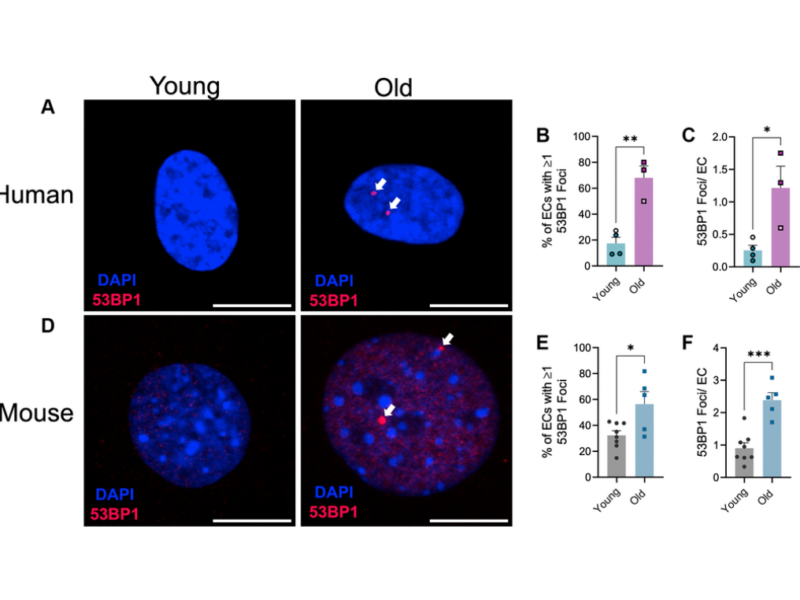 Figure 1. Effect of aging on endothelial cell DNA damage.