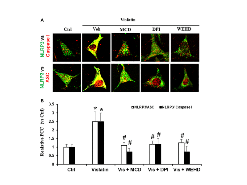 Contribution of membrane raft redox signalling to visfatin-induced inflammasome activation and podocyte injury