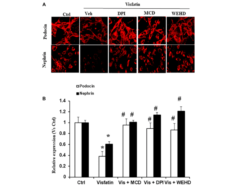 Figure 4. Effects of Visfatin on podocyte injury.
