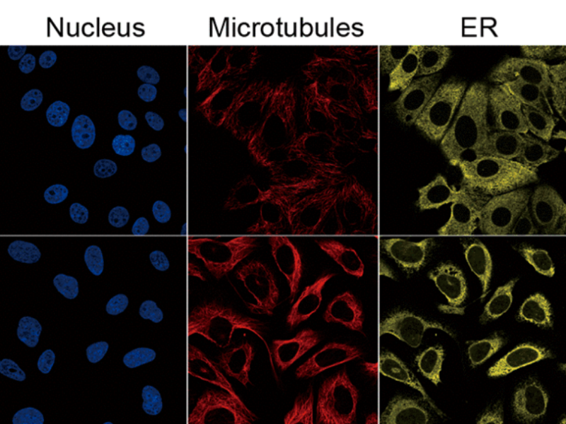 Aberrant RBMX expression is relevant for cancer prognosis and immunotherapy response