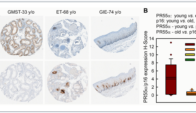 Figure 8. PR55α level is much lower in human normal tissue specimens of older individuals compared to younger individuals and inversely correlates with p16 levels. Human normal tissue specimens derived from various organs/sites were analyzed for differences in PR55α and p16 expression by IHC.
