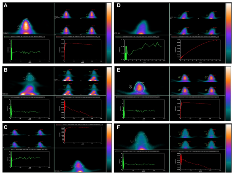 Figure 9. Effect of GNL on D-gal-induced cognitive impairment mice by using 99mTc-HMPAO (brain) animal imaging. 