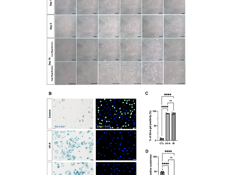 Figure 1. Morphological changes of human corneal endothelial cells after UV-A exposition.