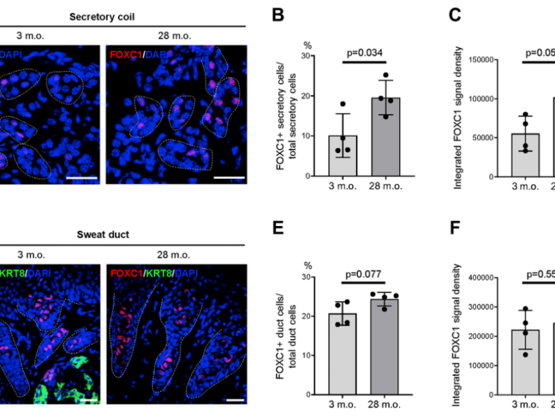 Figure 5. Expression changes of FOXC1 protein in old sweat glands.
