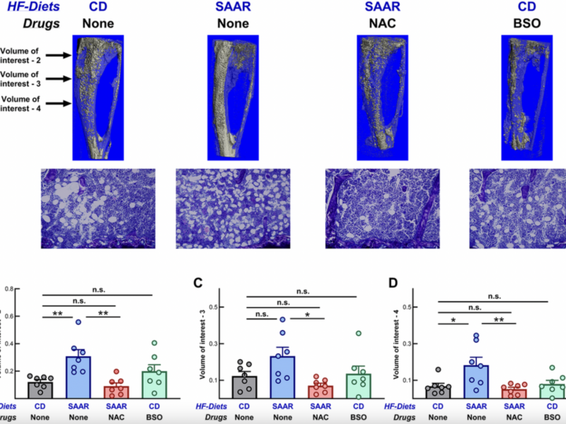 BSO Recapitulates Anti-Obesity Effects of Sulfur Amino Acid Restriction Without Bone Loss